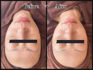 BELLÉ TRINITYのエステ・リラクイメージ