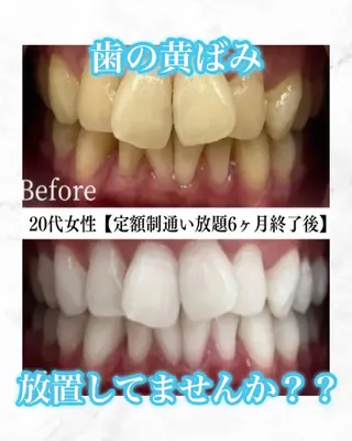 メンズ キッズ セルフホワイトニング WHITE福岡博多店のエステ・リラクイメージ