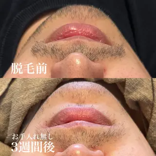 メンズ wax脱毛専門店 ハイラントのエステ・リラクイメージ