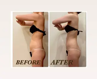 Prima 痩身脱毛 にごうかおりのエステ・リラクイメージ