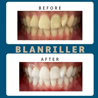 BLANRILLER所属・ホワイトニングサロン ブランリエ阿倍野店のその他イメージ