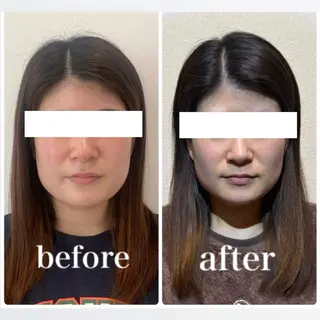 小顔と ヘッドスパのお店のエステ・リラクイメージ