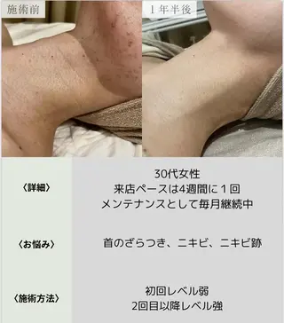 脱毛・眉毛・フェイス サロンN久留米店の眉毛・アイブロウイメージ