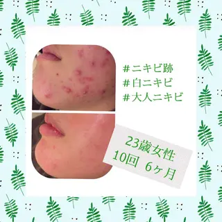 ミディアム カラー パーマ ヘアアレンジ メンズ キッズ ネイル マツエク・マツパ ニキビ・肌質改善専門 ♡人生が変わるサロンのエステ・リラクイメージ