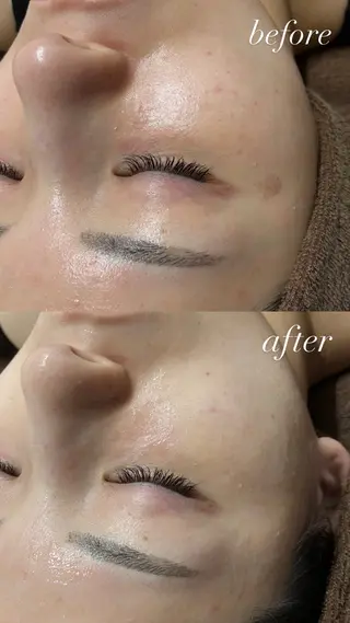 smileskin 京都/meguのその他イメージ