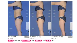 オレンジバナナ 新潟店のエステ・リラクイメージ