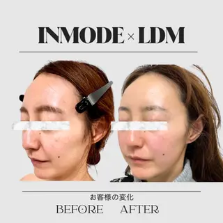 aimer 服部のその他イメージ