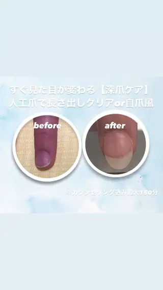 メンズ ネイル 爪ケア/深爪 自爪育成 🐰えむのネイルデザイン