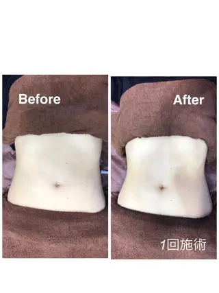 痩身/美肌/脱毛 MAX BEAUTYのエステ・リラクイメージ