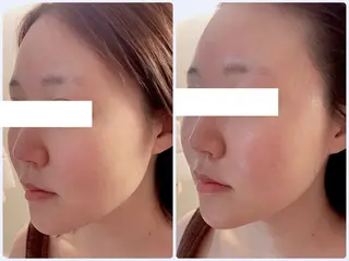 Anjir(アンジール)所属・完全個室サロン Anjirのエステ・リラクイメージ