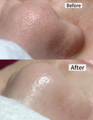 LUMINA ESTHのエステ・リラクイメージ