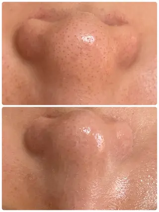 心満たされる ハーブピーリング絹々のエステ・リラクイメージ