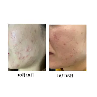 De I'm 可児店のエステ・リラクイメージ