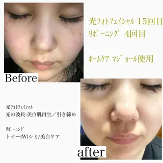 gratia ~ｸﾞﾚｲﾃｨｱ~のエステ・リラクイメージ