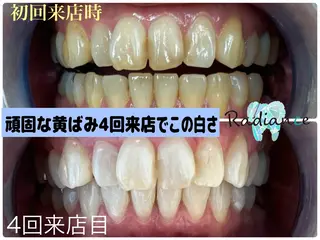 札幌ホワイトニング ラディアンス札幌駅店のその他イメージ