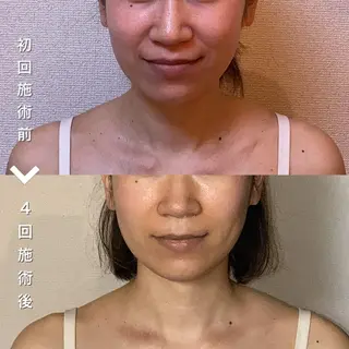 自律神経を整える ボディケアサロンのエステ・リラクイメージ