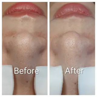 ポアレスサロン フィルのエステ・リラクイメージ