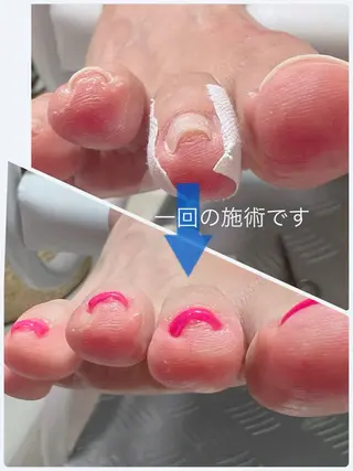 ネイル and Lilyのネイルデザイン