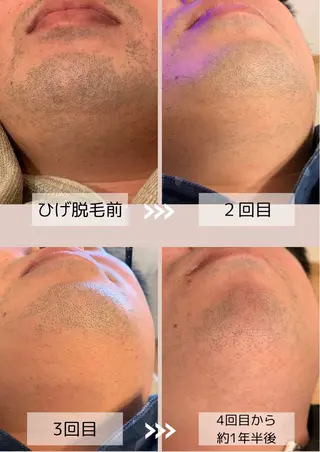 メンズ 脱毛サロン Arumのエステ・リラクイメージ