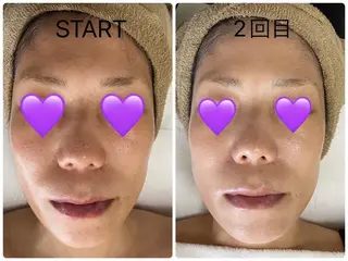 COCO beautyサロンのエステ・リラクイメージ
