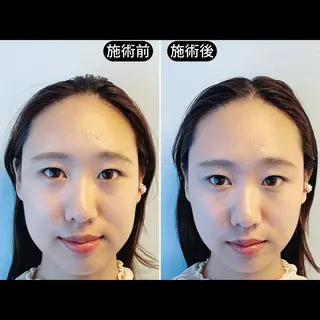 渋谷 小顔美容鍼 専門サロン YZのエステ・リラクイメージ