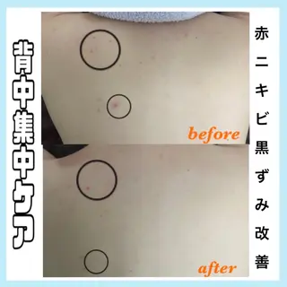 オールハンド専門🤍 痩身/小顔/ ハーブのエステ・リラクイメージ