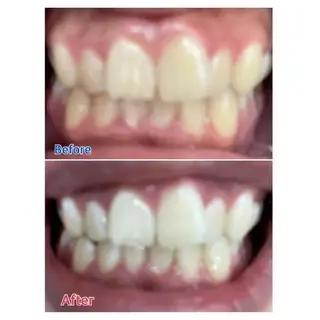 M渋谷 ホワイトニングのエステ・リラクイメージ