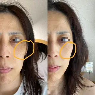 Meetite 小林のエステ・リラクイメージ