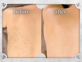 都度払い脱毛 Lino柏/Moneのエステ・リラクイメージ