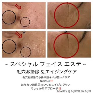 ビューティー ミロワールのエステ・リラクイメージ