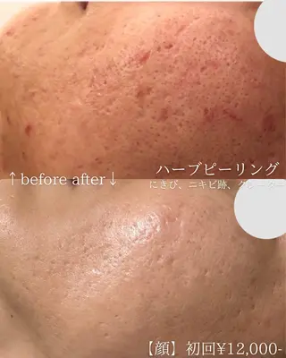 毛穴改善サロン d'Alba大阪住吉のエステ・リラクイメージ