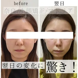 小顔 美肌専門 Matoriaのエステ・リラクイメージ
