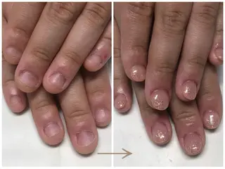 ネイル 深爪矯正・自爪育成 ヴェールリムのネイルデザイン