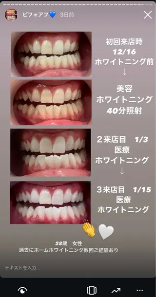Kaula ホワイトニング🦷✨のエステ・リラクイメージ