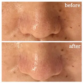 フェイシャル専門サロ ン　ERINのエステ・リラクイメージ