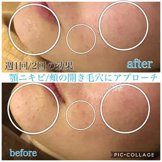 ショート カラー パーマ ヘアアレンジ キッズ ネイル マツエク・マツパ EnsorClair 代表 野口真央のエステ・リラクイメージ