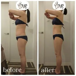 痩身脱毛専門店 Partirのエステ・リラクイメージ