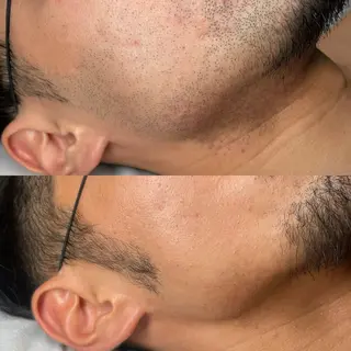 メンズ mimi 広島 安佐南区まつ毛･脱毛のマツエク・マツパデザイン