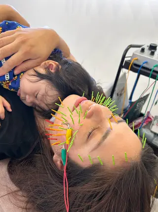 キッズ 美容鍼灸Solana所属・肌質改善×美容鍼 ゆいのエステ・リラクイメージ