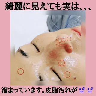 マツエク・マツパ アイブロウ DeRiii 毛穴・ 保湿ケアまつ毛パーマのエステ・リラクイメージ