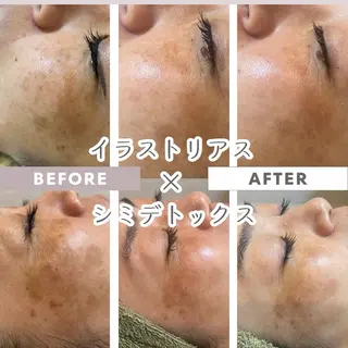 ROOM.S |脱毛|美肌|ボディのエステ・リラクイメージ