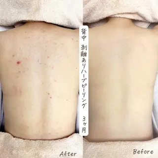 肌質改善サロン renew/ｳｴｷのエステ・リラクイメージ