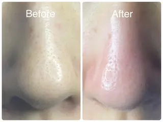 salon HATOのエステ・リラクイメージ