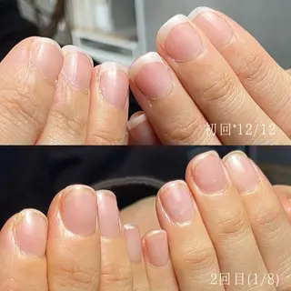 ネイル Aim* 深爪自爪育成専門店のネイルデザイン