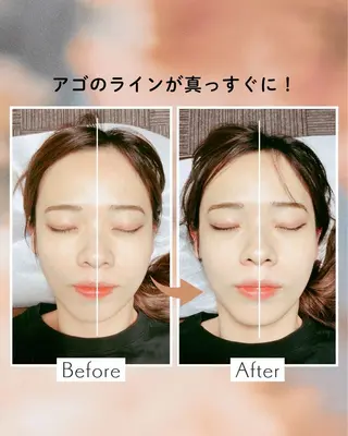 山﨑 竜二のエステ・リラクイメージ