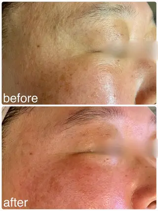 Hisui 小出のエステ・リラクイメージ