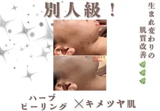 🌷U24特別サロン レイビス銀座店🌷のエステ・リラクイメージ