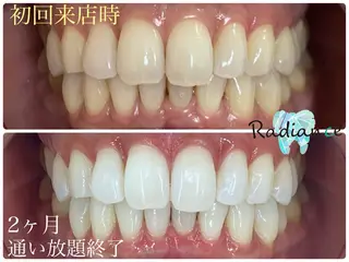 札幌ホワイトニング ラディアンス札幌駅店のその他イメージ