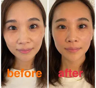 美容鍼灸サロン mahoroba院長のエステ・リラクイメージ