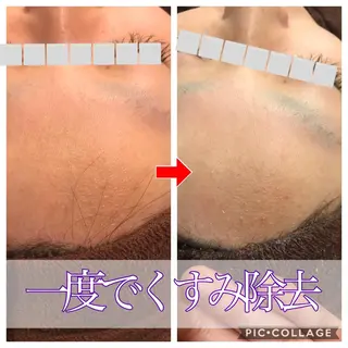 セミロング カラー パーマ ヘアアレンジ メンズ キッズ ネイル マツエク・マツパ 金の糸脱毛 産毛ケア専門のエステ・リラクイメージ
